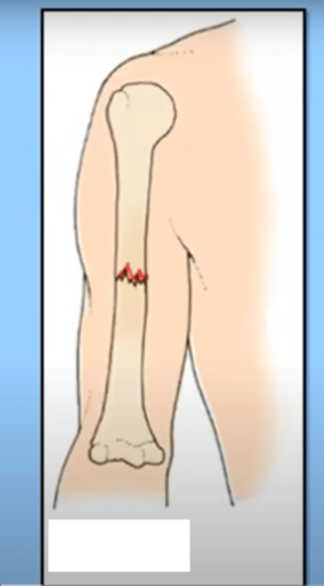 <p>the separate fragments are in touch/aligned</p>