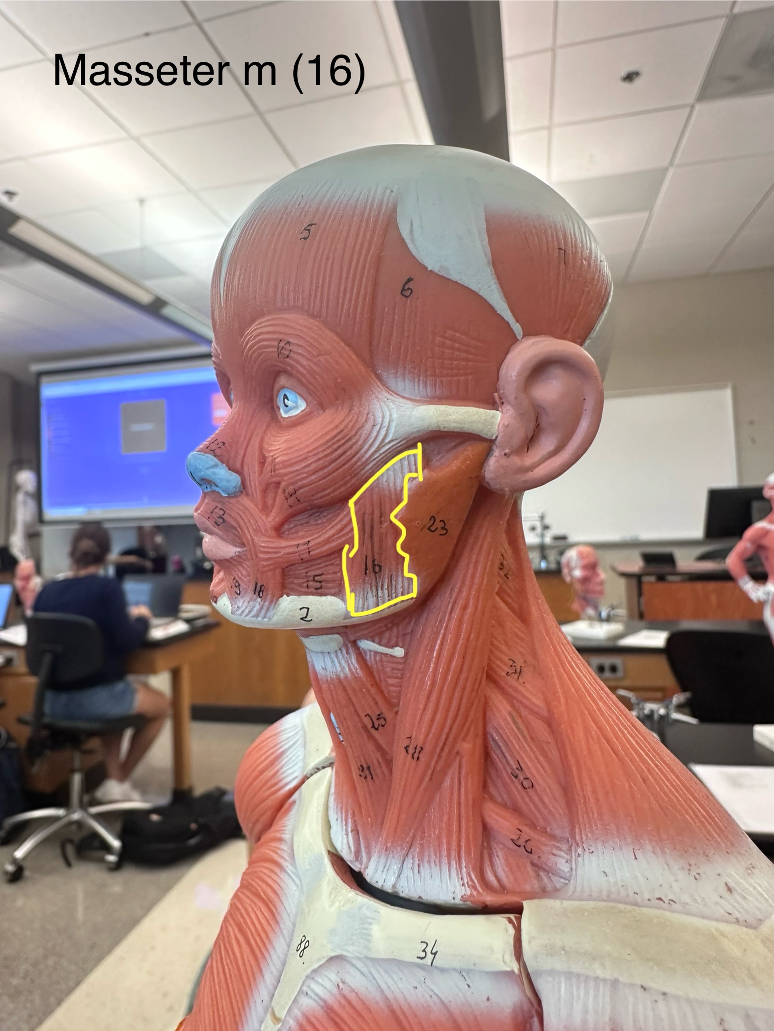 <p>Masseter muscle. This muscle is the prime mover of jaw closure.</p><ul><li><p>The origin is the zygomatic arch and zygomatic bone. </p></li><li><p>The insertion is the angle and ramus of the mandible.</p></li></ul>