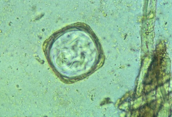 <p>This was found on the fecal float of a heifer.</p>