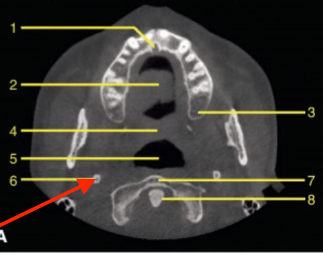 <p>identify the structure </p>