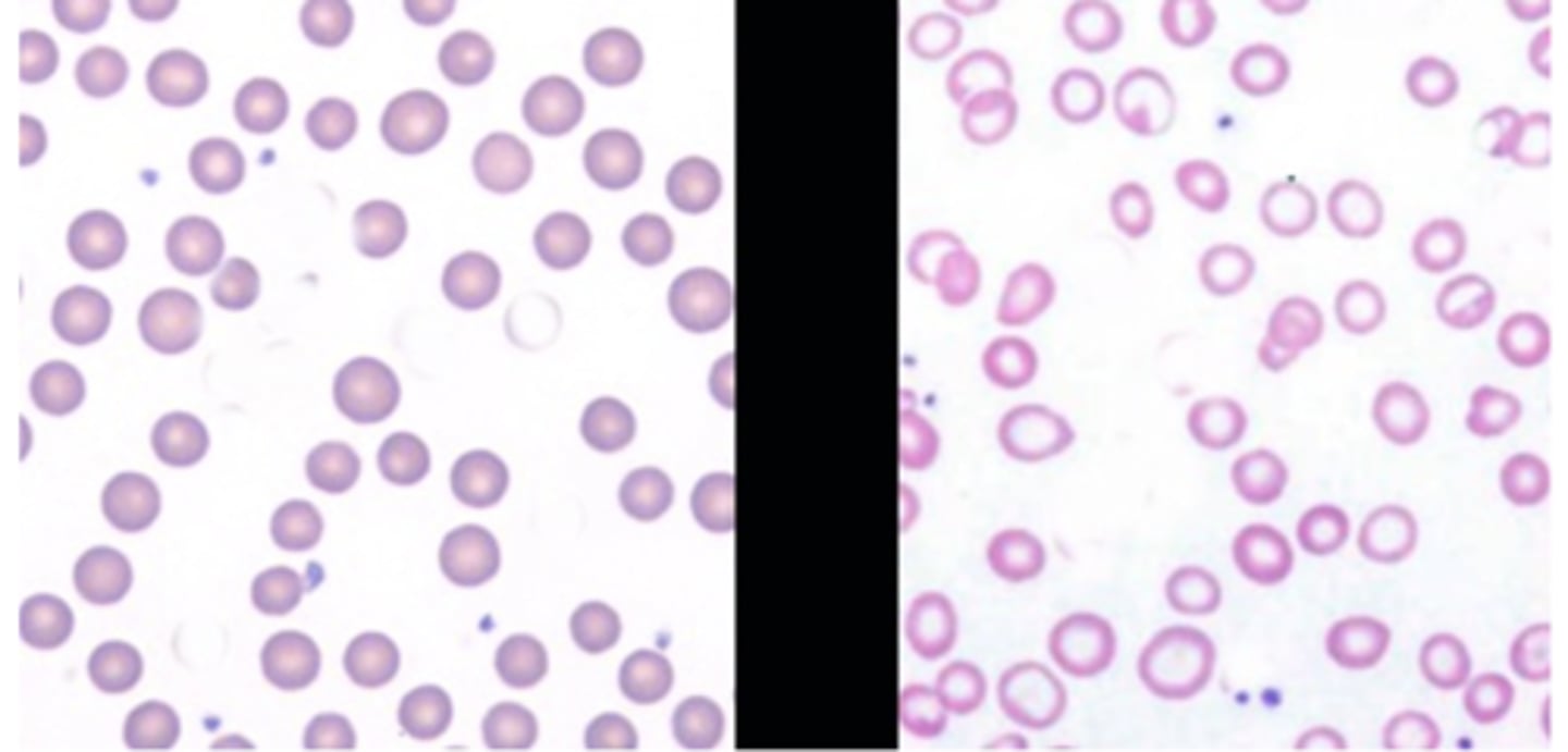 <p>what is wrong with the RBCs on the right?</p>