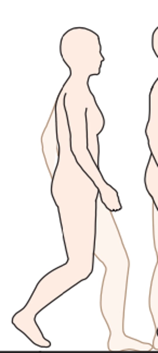 <p>What stance is this according to Ranchos Los Amigos?</p>
