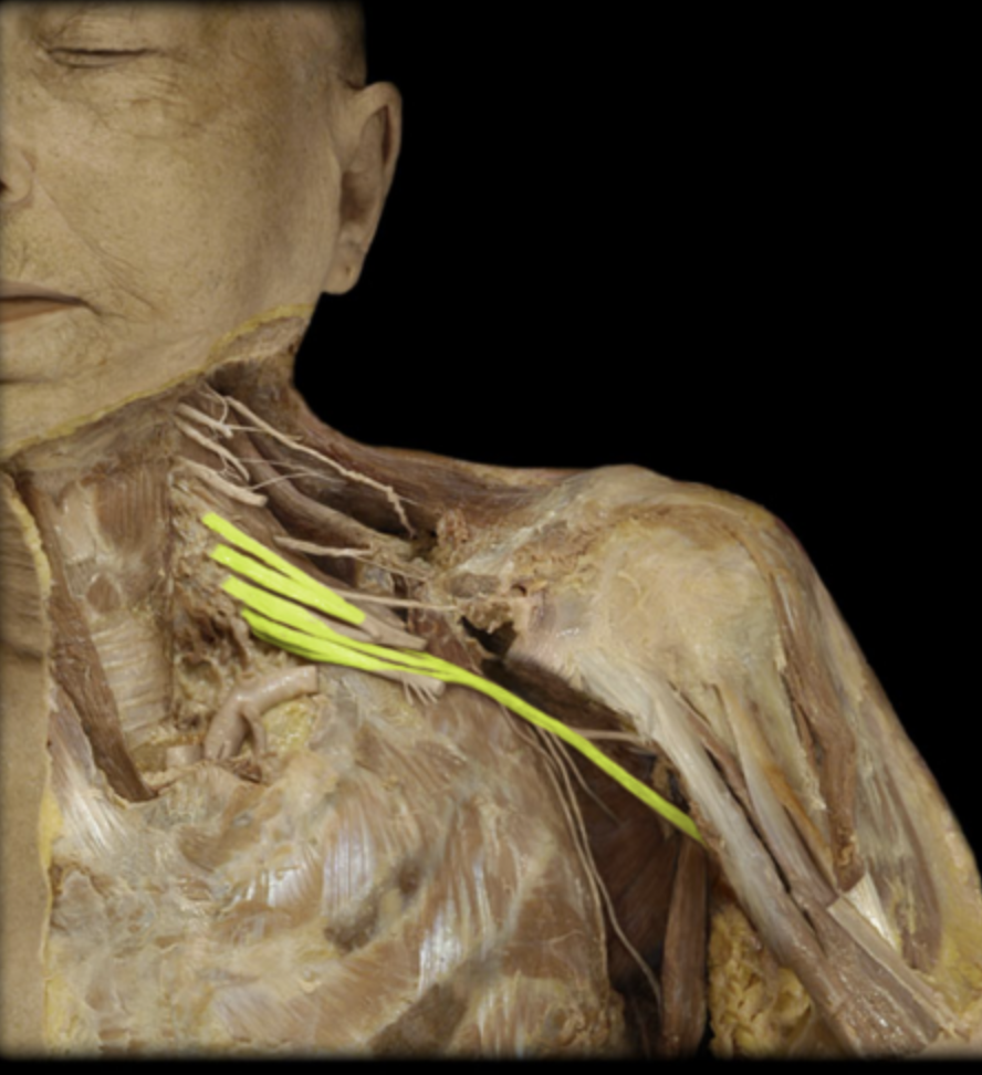 <p><em>table 7, posterior cord terminal branch</em><br><span><em>supplies all extensors of arm and forearm</em></span></p>