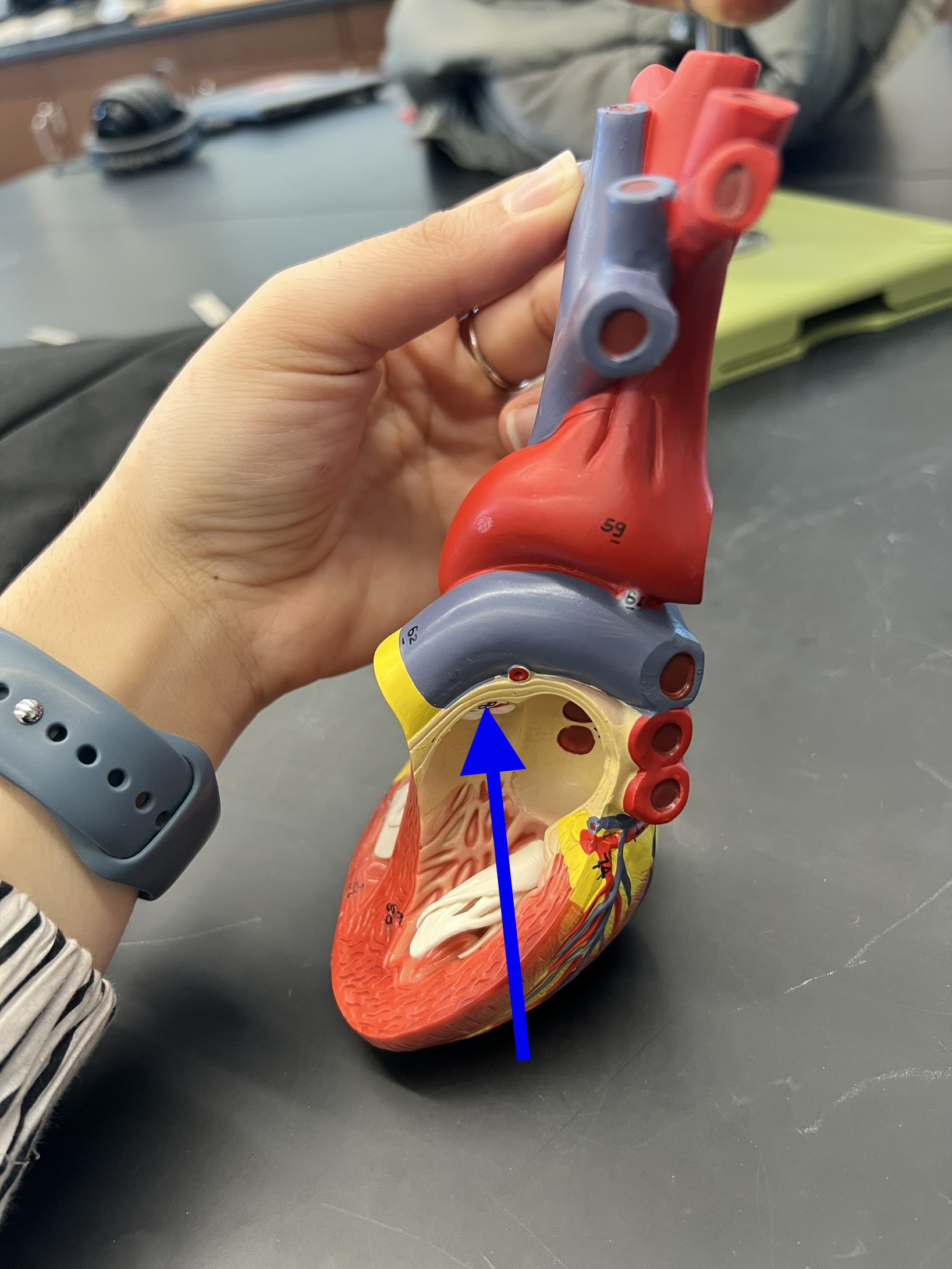 Name the heart structure.