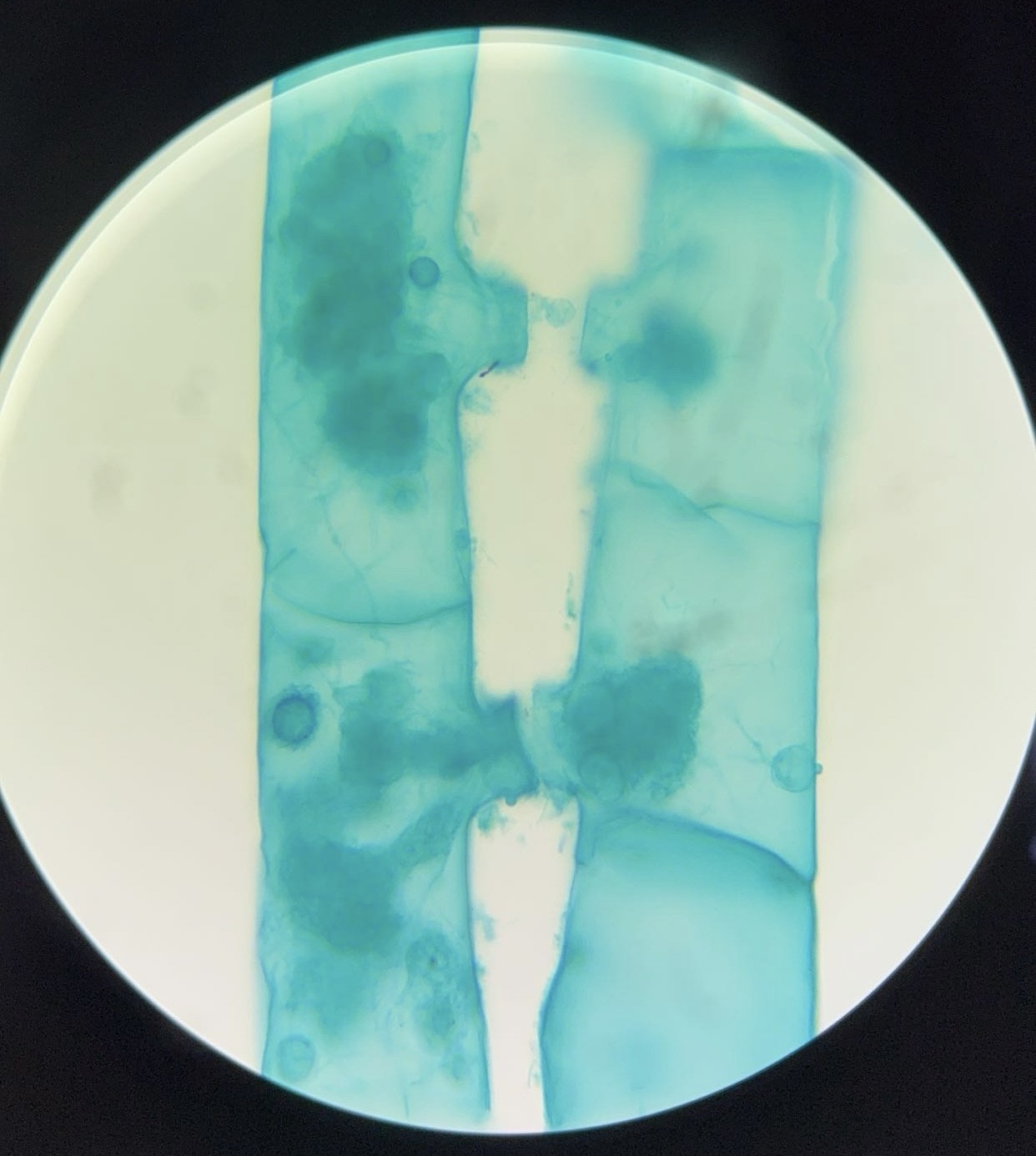 <p><span>What is this organism?</span></p>