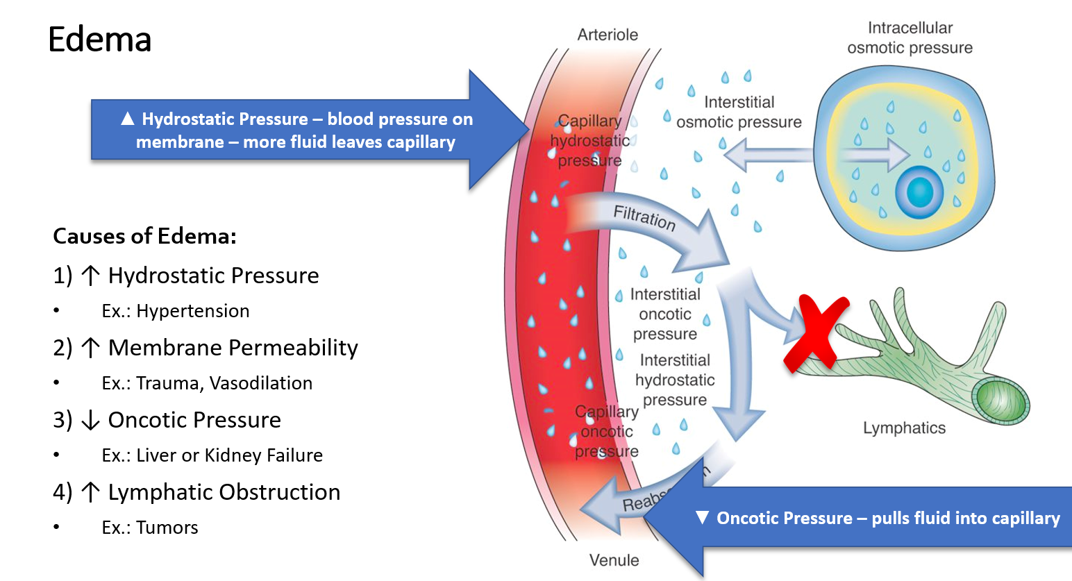 <ol><li><p>An elevated hydrostatic pressure (ex. hypertension = more tension on capillary walls = water will be pushed out of the vessel </p></li><li><p>Increase in membrane permeability (ex. inflammation)</p></li><li><p>Low oncotic pressure (ex. malnutrition leading to less albumin in the blood which helps retaining water in the vessel)</p></li><li><p>Lymphatic obstruction (ex. lymphoma)</p></li></ol><p></p>