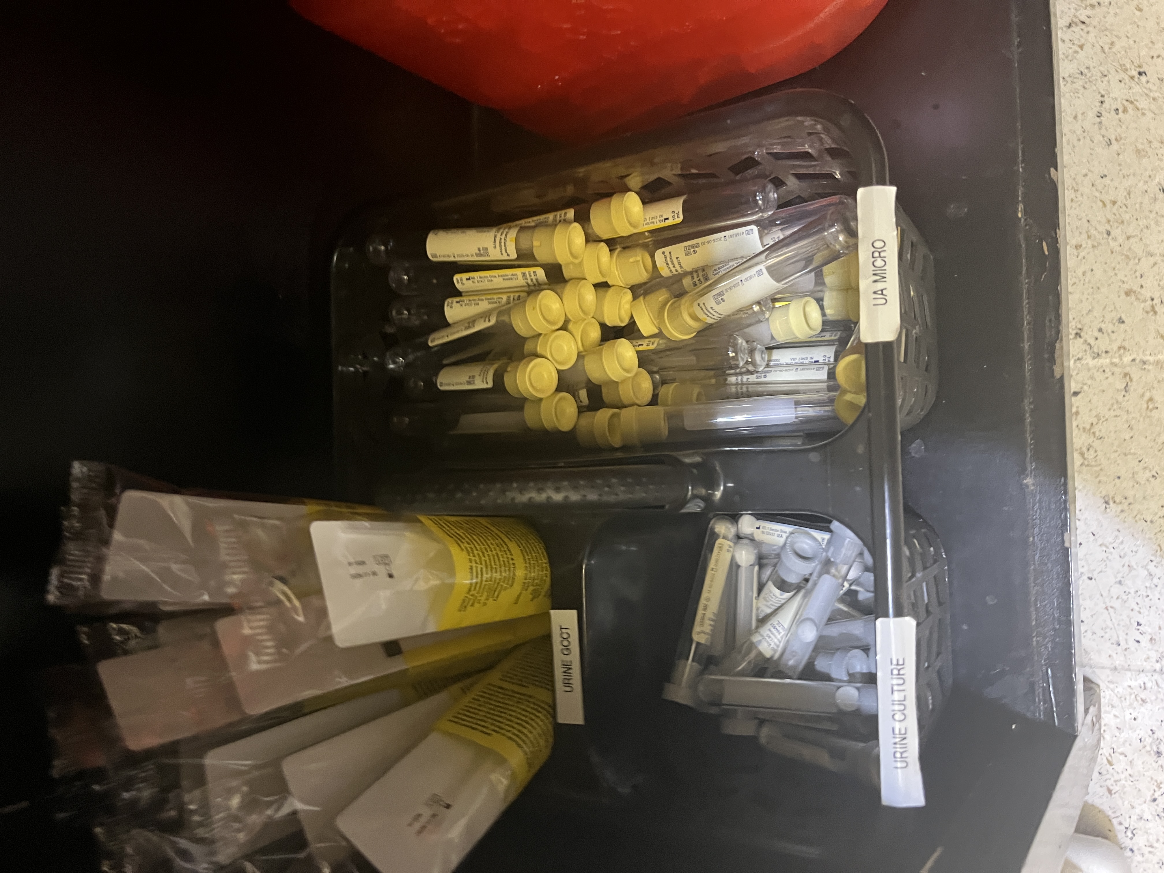 <p>What does the UA Micro (Basic Yellow Tube) test for?</p>