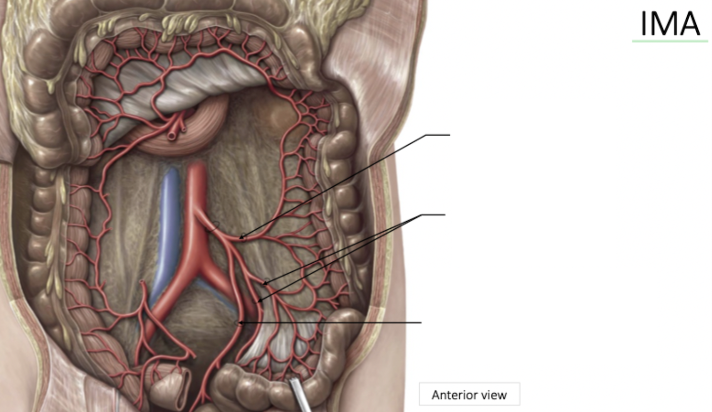 <p>Inferior Mesenteric Artery</p>