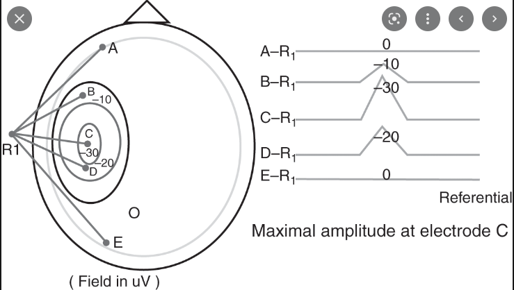 <p>head diagram of electrodes with areas of activity mapped by most to least active</p>