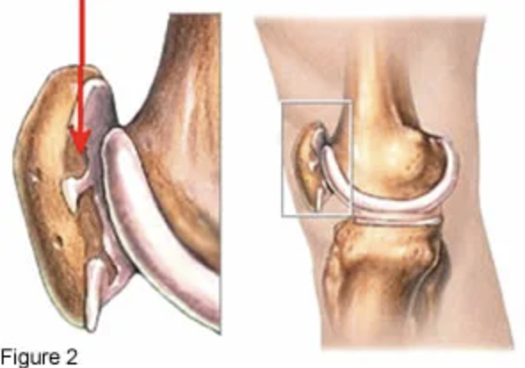 what injury is this?