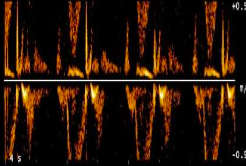 <p>Chose all of the following that will fix this image.</p><p>a. move baseline</p><p>b. use CW doppler</p><p>c. Increase scale</p><p>d. change to a higher frequency TX</p>