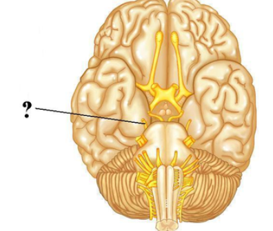 <p><span><span>Identify the indicated cranial nerve.</span></span></p>
