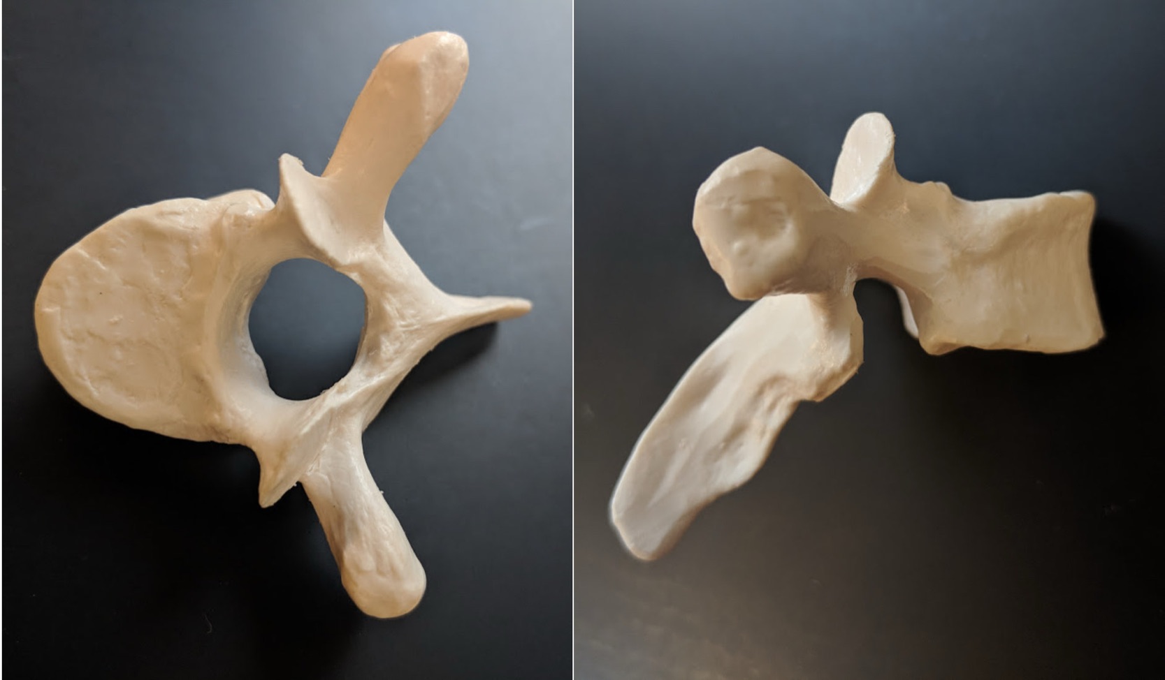 <p>Name this bone</p>