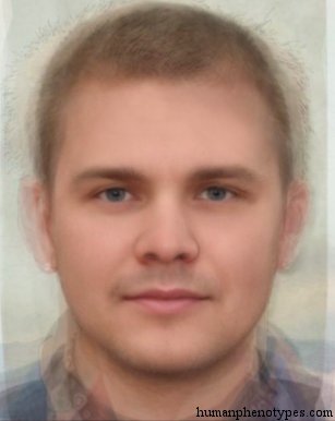 <p>Identify this Phenotype</p>