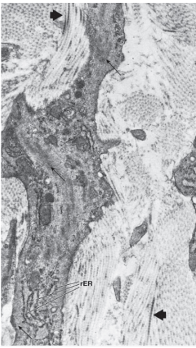 <p>Describe the nucleus of myofibroblasts.</p>