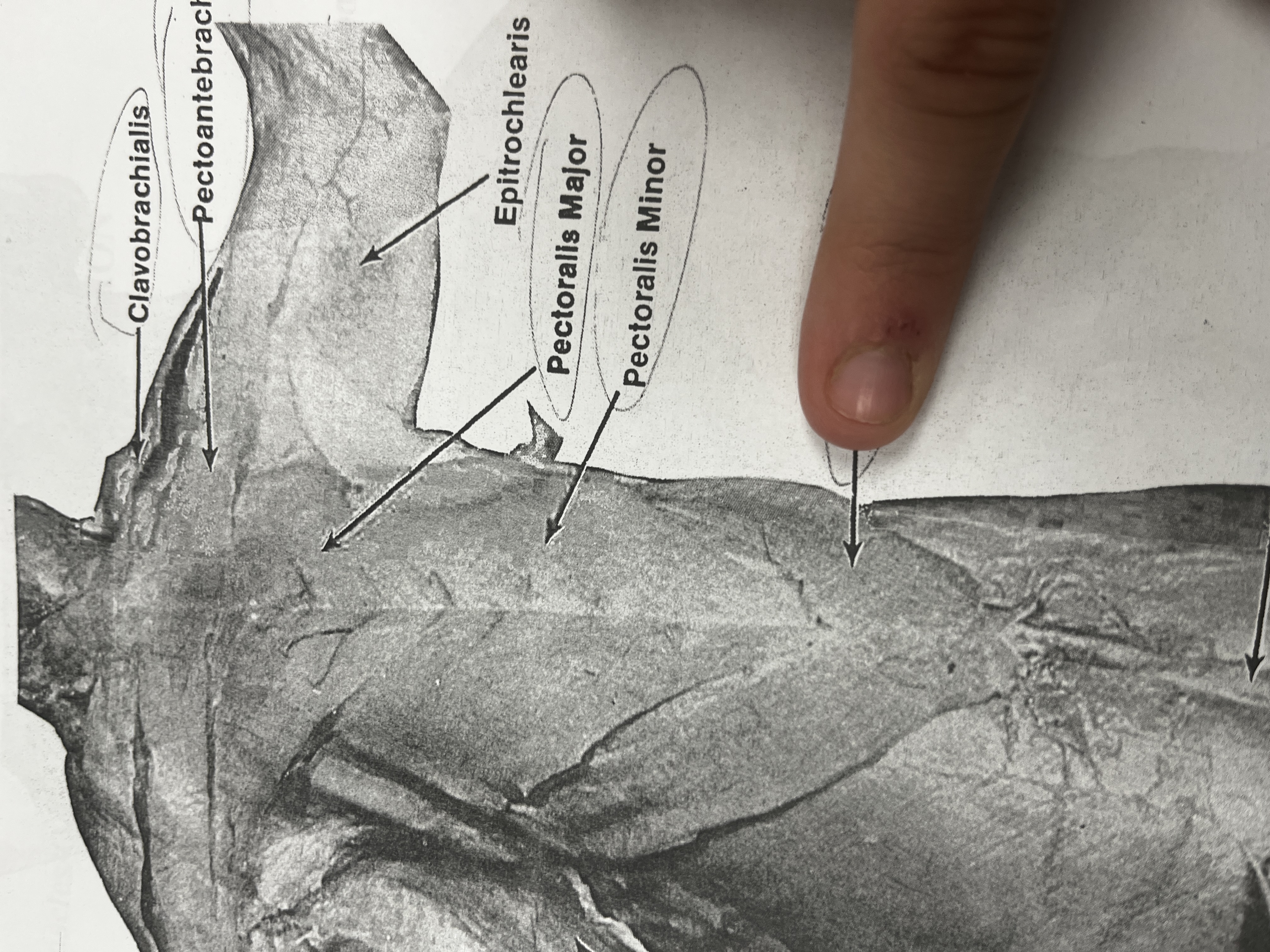 <p>A muscle in cats that assists in the movement of the forelimb.</p>