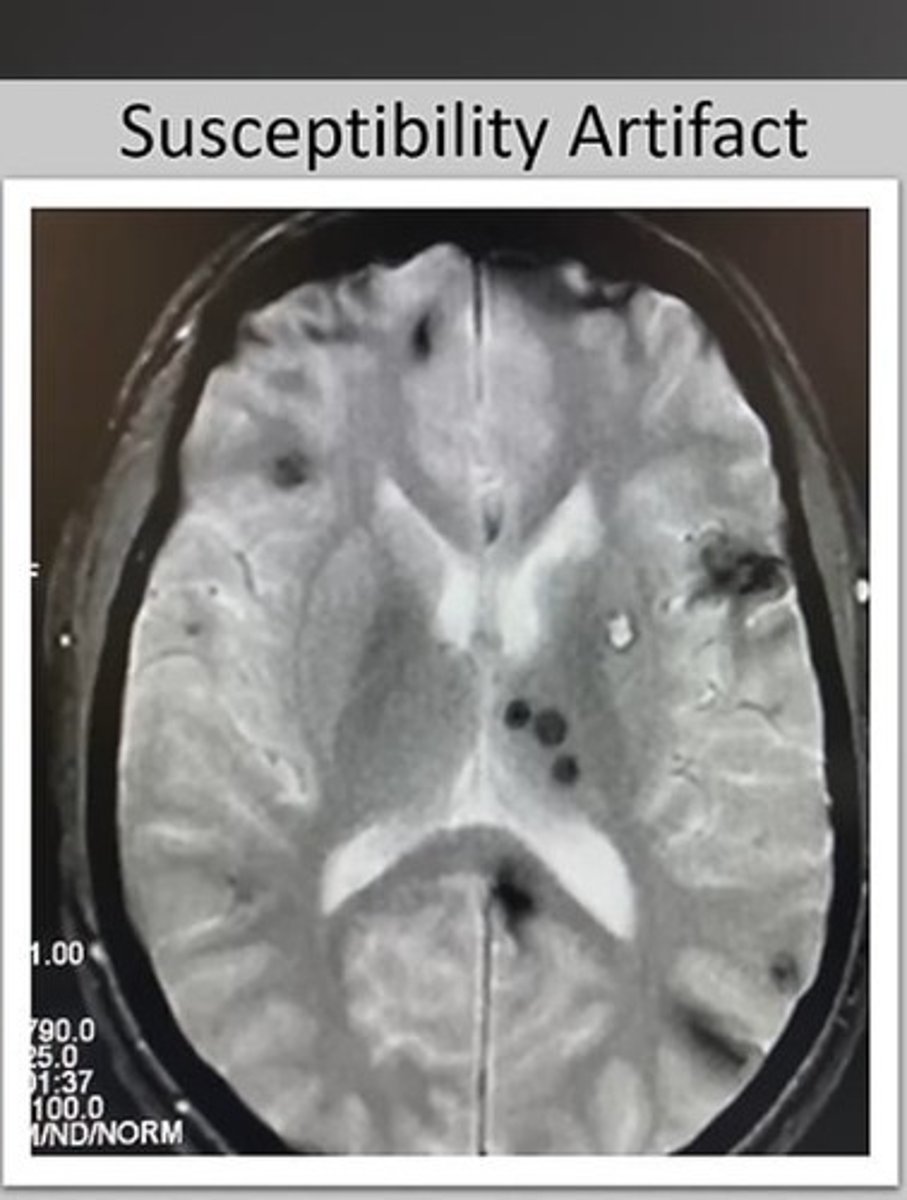 <p>Motion, RF, Wrap, Chemical Shift, Cross-talk, Grad Warp, Metal susceptibility, Herring Bone, and Annefact.</p>