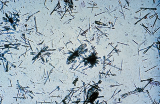 Ampicillin crystals after refrigeration