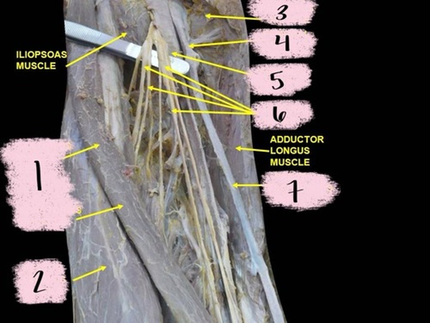 knowt flashcard image