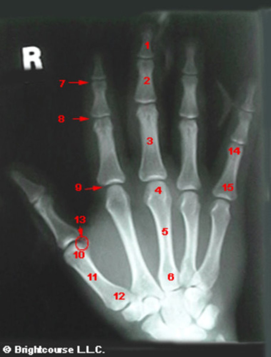 <p>What structure is indicated by number 5?</p>