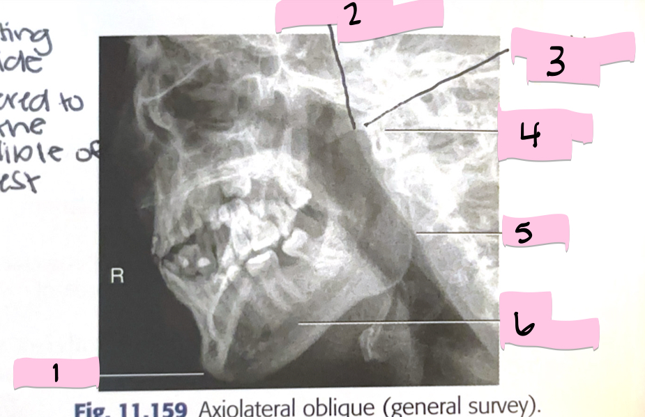 <p>What is 2 pointing to?</p>