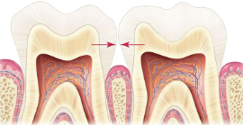 <p>The places where adjacent teeth touch each other.</p>