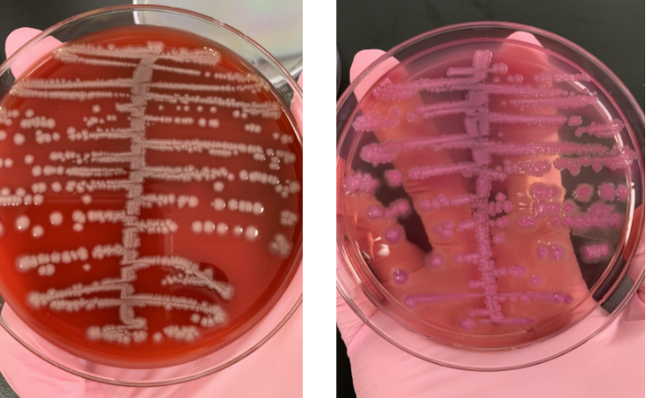 <p>lets say the indole was (+) and you ended up doing a citrate tube and it was (-), what organism would this be</p>