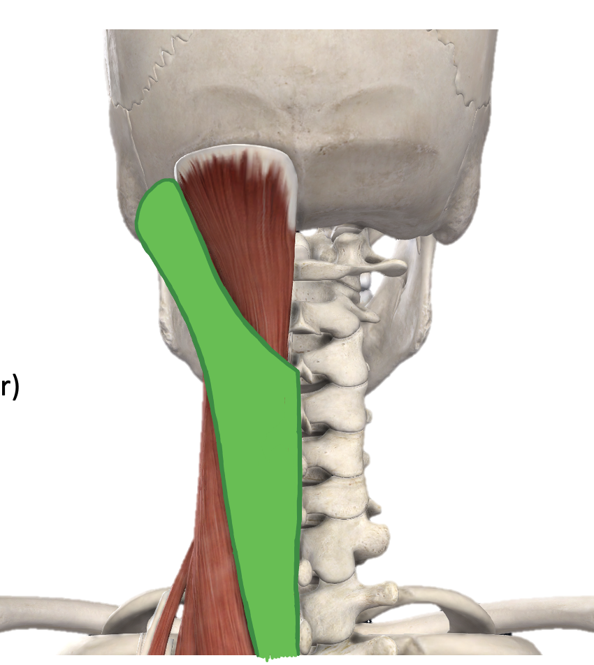 <p>Action and innervation of <strong>Splenius Capitis muscle</strong></p>