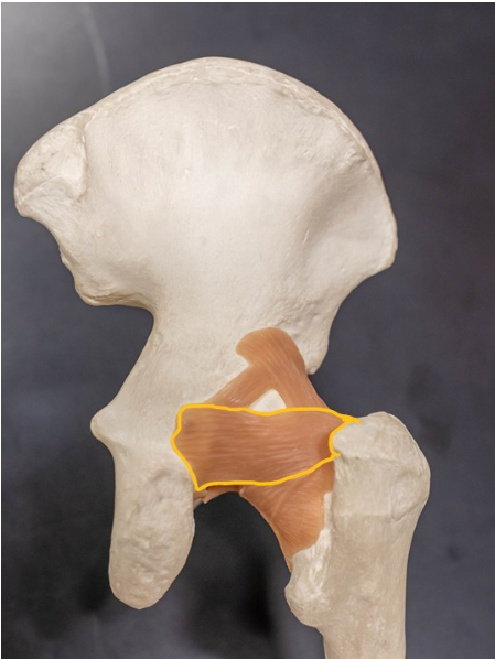 <p>What is this ligament highlighted in yellow</p>