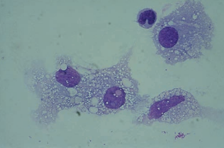 Figure 10: Macrophages