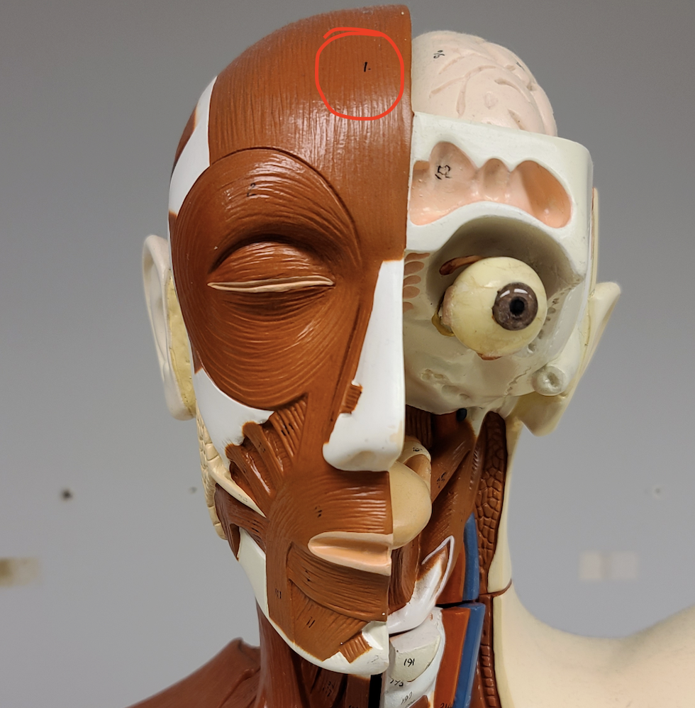 <p>1 (red circle)</p>