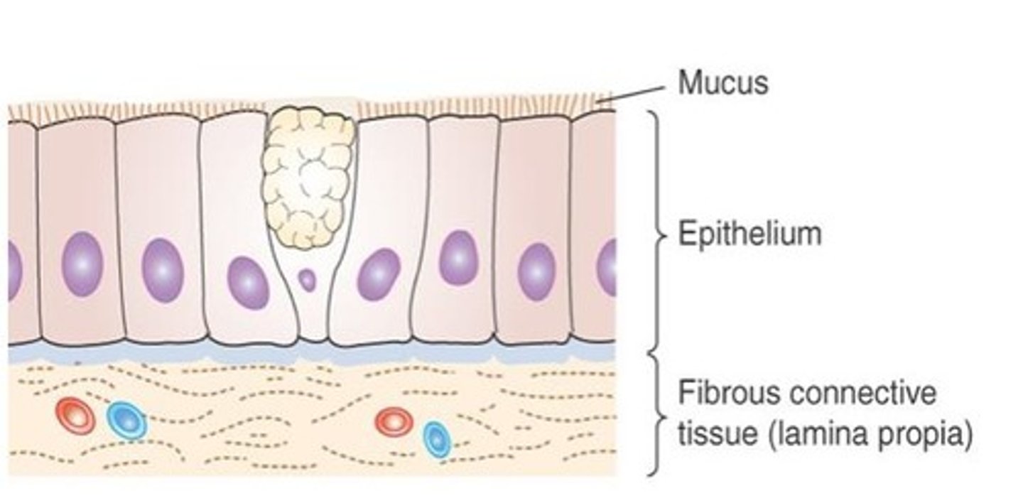 <p>Goblet cells, cilia, and microvilli.</p>