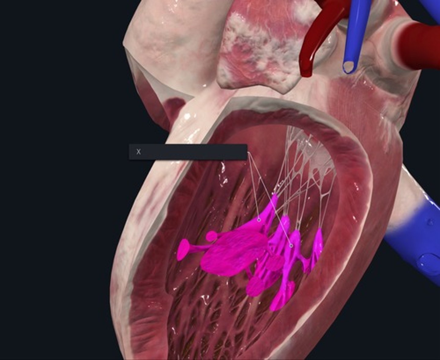 <p>Name the Muscles marked with the X and highlighted pink</p>