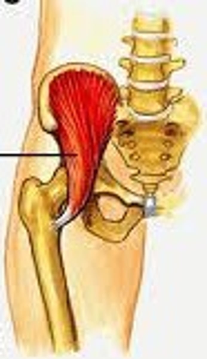 <p>With psoas into lesser trochanter of femur</p>