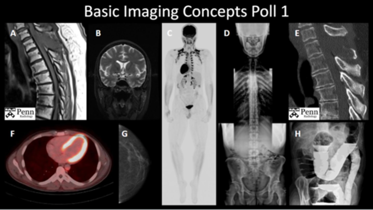 <p>a. thoracic spine MRI</p><p>b. brain MRI</p><p>c. whole body PET scan</p><p>d. full spine XRAY</p><p>e. sagittal CT scan</p><p>f. PET CT fusion</p><p>g. mammography</p><p>h. barium enema contrast XRAY</p>