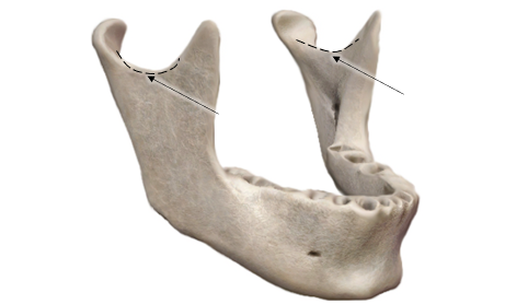 <p><span>Name the indentation (singular).</span></p>