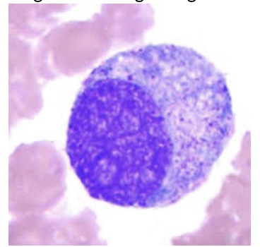 <p><span style="font-family: Helvetica; font-size: 12px;">Which of the following is FALSE regarding this cell type:</span></p><p><span style="font-family: Helvetica; font-size: 12px;">a. Has azurophilic (primary) granules in the cytoplasm</span></p><p><span style="font-family: Helvetica; font-size: 12px;">b. Has secondary (specific) granules in the cytoplasm</span></p><p><span style="font-family: Helvetica; font-size: 12px;">c. Is the stage of neutrophil development after the blast stage - identified as promyelocyte</span></p><p><span style="font-family: Helvetica; font-size: 12px;">d. ﻿﻿﻿May be larger than the blast stage</span></p><p></p>