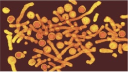 <p>Genus-Hepadnavirus</p>
