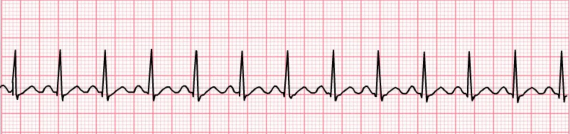 <p>What rhythm is this?</p>
