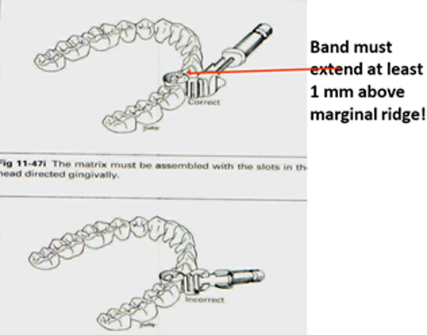 <p>slots face gingivally and band arch goes towards occlusal</p>