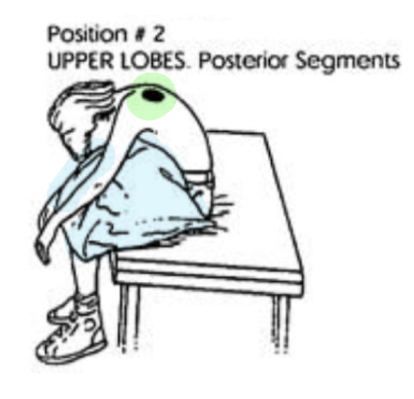 <ul><li><p>Seated, Leaning Forwards 30 deg</p></li></ul><p></p>
