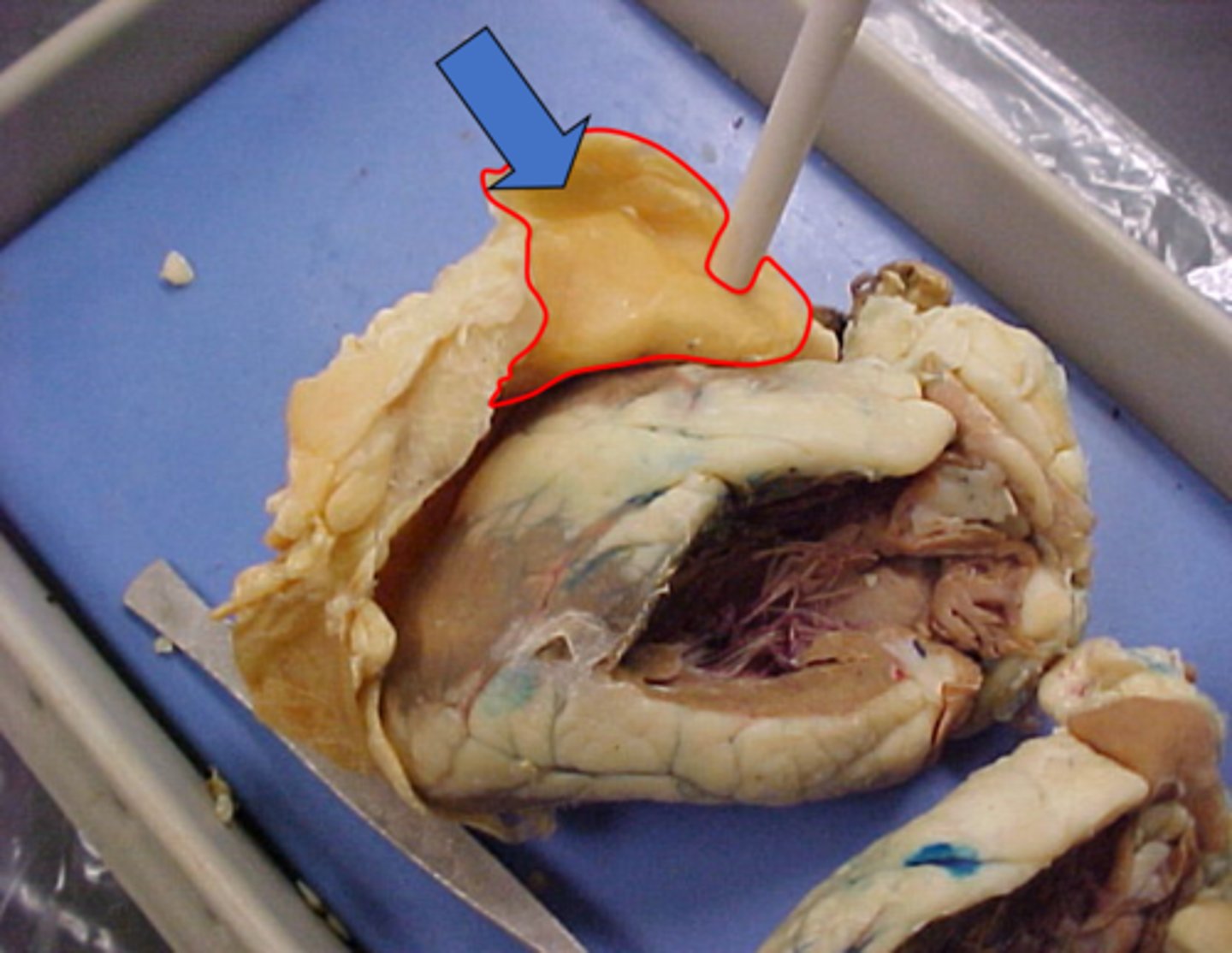 <p>Name this layer.</p>
