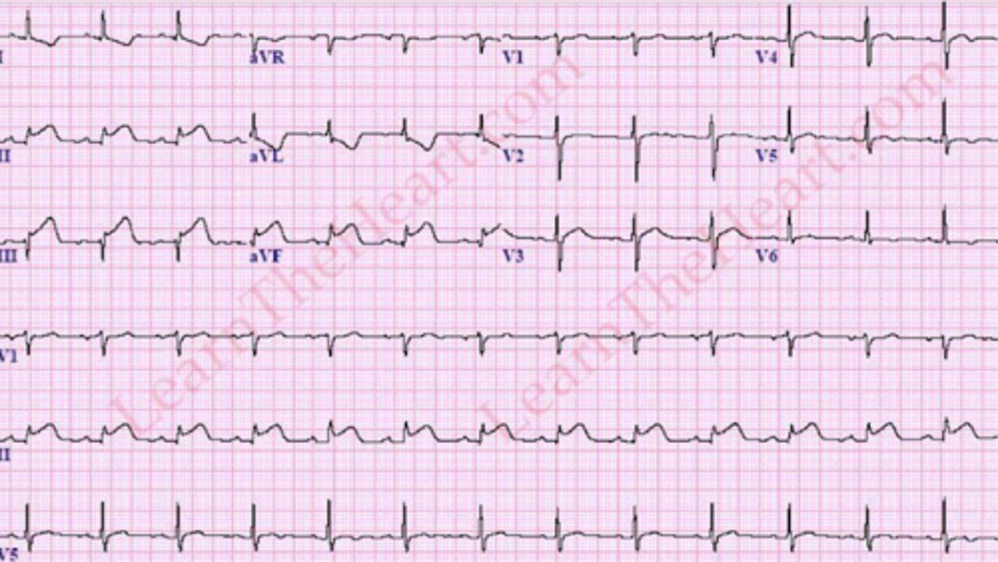 <p>What are the findings</p>