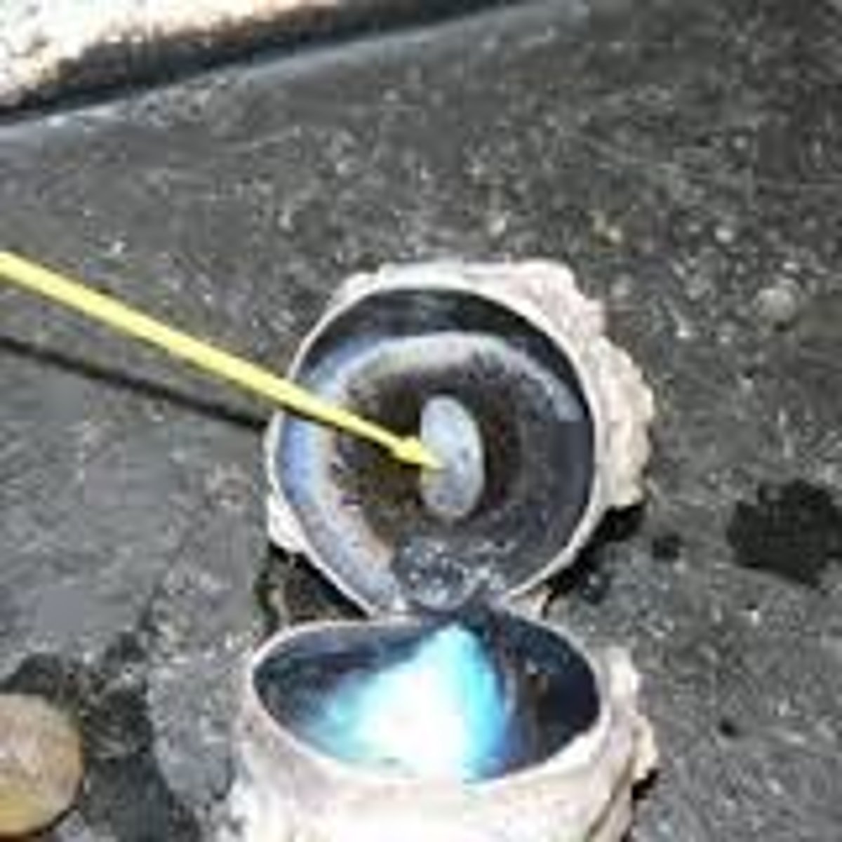<p>Identify the cavity</p>