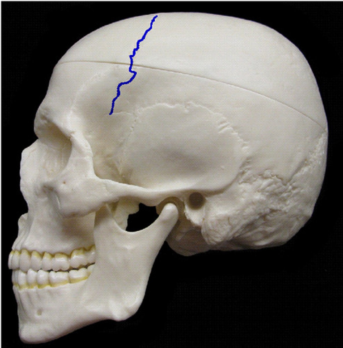 <p>ID joint shown in purple</p>