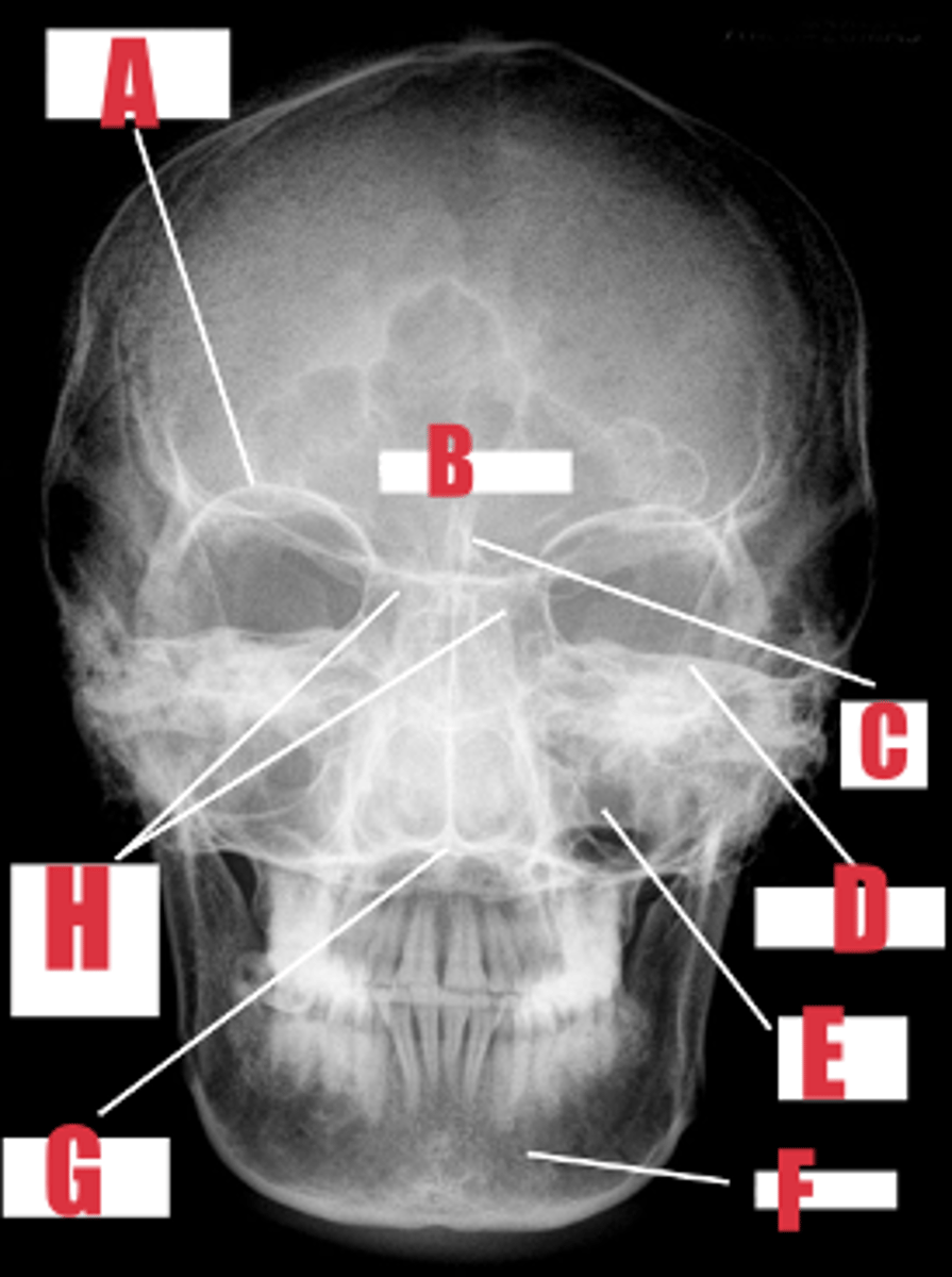 <p>what part of bone is D</p>