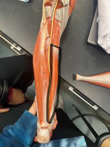 <p>Flexes toes 2-5, crosses with flexor hallicus longus</p>