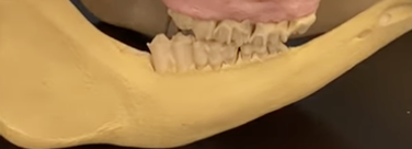 <p>bottom jaw</p>