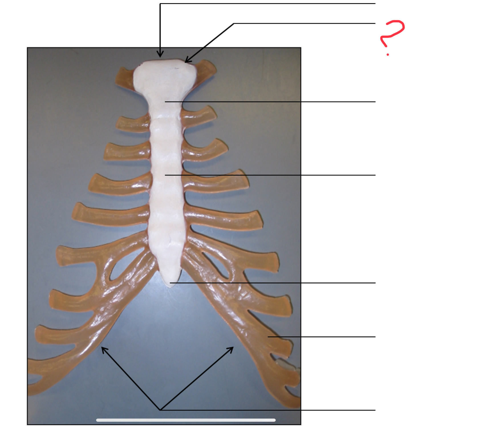 <p>clavicular notch</p>