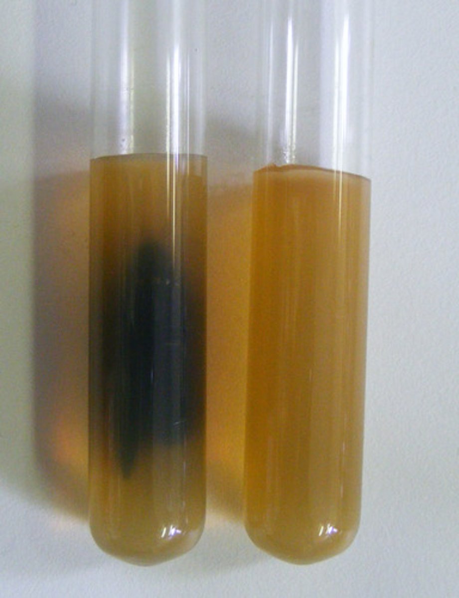 <p>Black medium in TSI Agar</p>